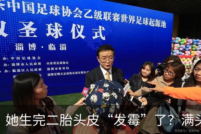 她生完二胎头皮“发霉”了？满头结出恐怖硬壳，一头金发全掉光